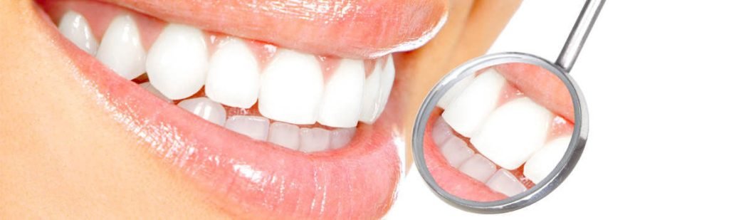 Different Methods of Teeth Whitening