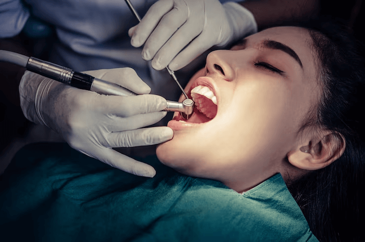When Do You Really Need a Root Canal?