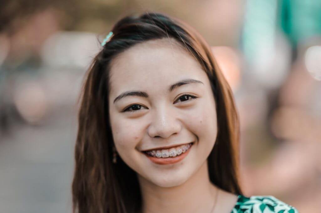 Different Types of Braces