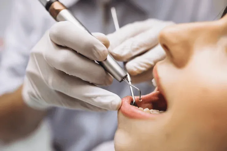 Tooth Extraction Recovery Guide: Post-Operative Care Tips