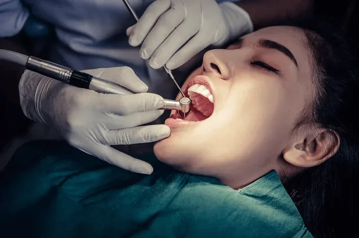 Root Canal Treatment Cost in Bangalore: Price, Procedure, and Factors Affecting Cost (2026 Guide)