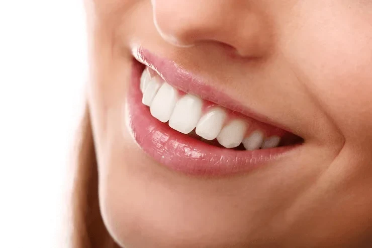 Is a Smile Makeover Worth It In Bangalore? Cost, Results & Honest Dentist Advice