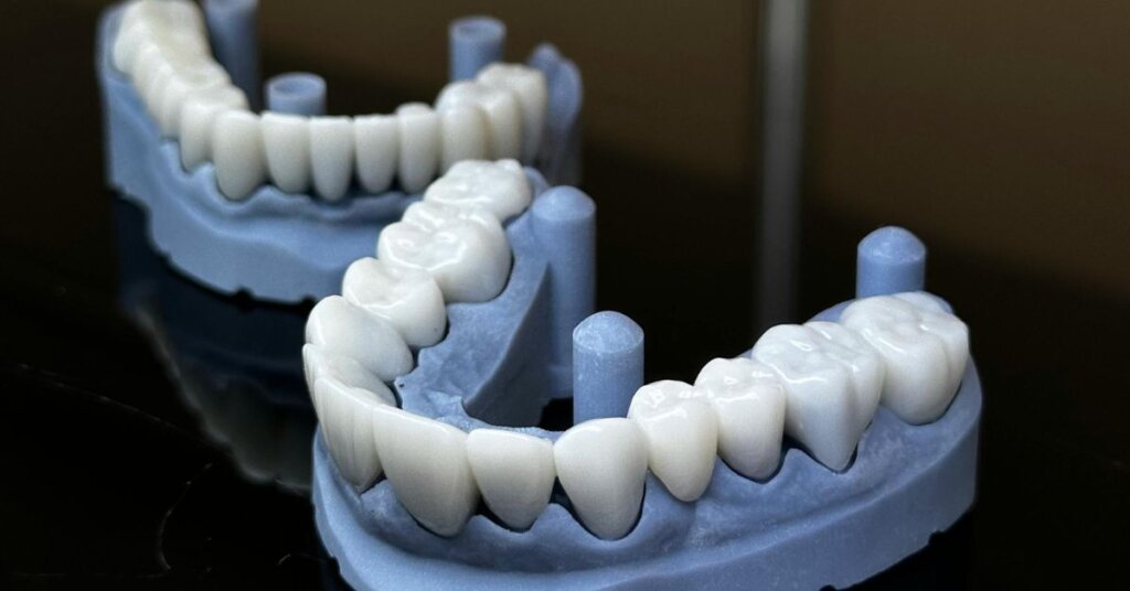 What Are Dental Crowns and Bridges Used For?