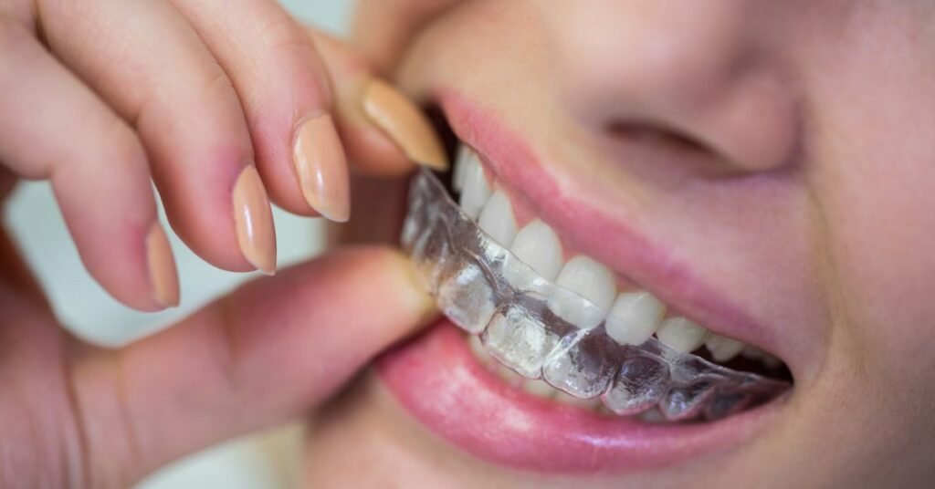 What Makes Invisalign Different from Braces?