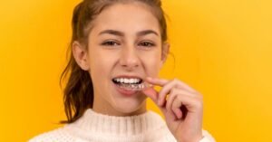 invisalign Bangalore invisalign Bangalore