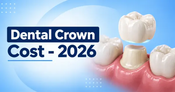 Dental Crown Cost in Bangalore