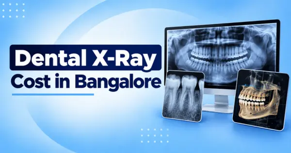 Dental X-Ray Cost in Bangalore